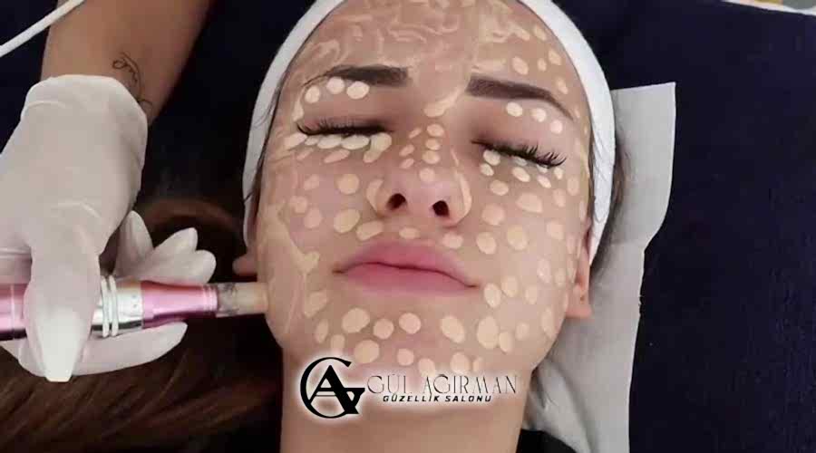 Antalya BB Shine Uygulaması